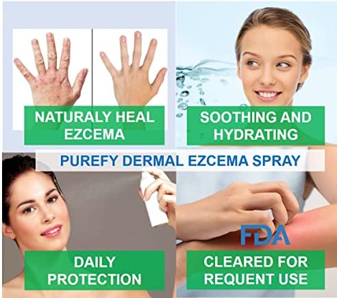 PUREFY Bőrön Ekcéma Airesol Spray (3.4 oz, 2pk) Természetes Gyógyító. Purefypro Tisztító Technológia. Biztonságos a Gyerekek,